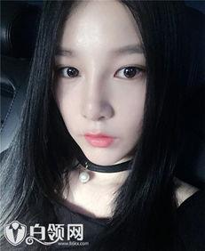 本兮整容前后照片对比,本兮整容前后惊人对比揭秘